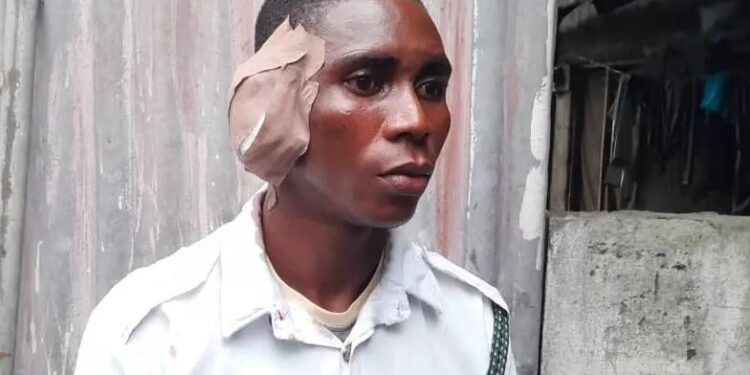 Drama As Driver Bites Off VIO officer’s Ear In Delta