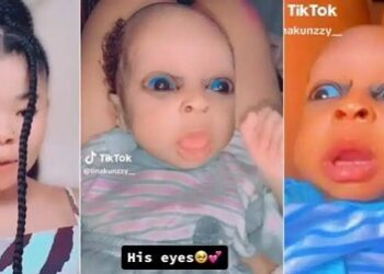 They’re Special Kids – Nigerian Mum Flaunts Her Twin Babies With Unique Blue Eyes (Video)