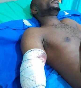 So Sad: Industrial Machine Cuts Off Worker’s Hand in Ogun (Photo)
