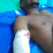 So Sad: Industrial Machine Cuts Off Worker’s Hand in Ogun (Photo)