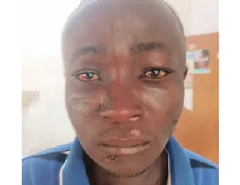 23-Year-Old Man Allegedly Confesses To Being A Witch And Turning His Neighbour To A Chicken In Adamawa