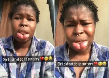 I’ve Spent A Lot of Money – Lady Whose Lips Began Swelling 2 Years Ago Cries Out (Video)