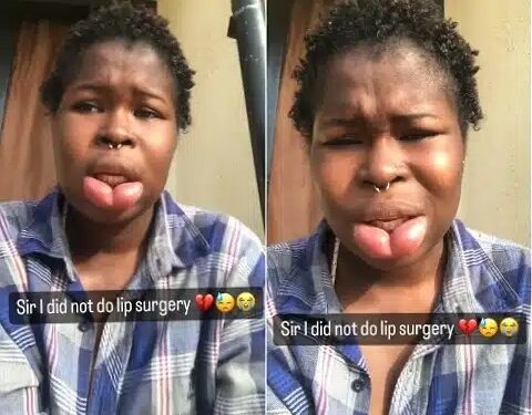 I’ve Spent A Lot of Money – Lady Whose Lips Began Swelling 2 Years Ago Cries Out (Video)