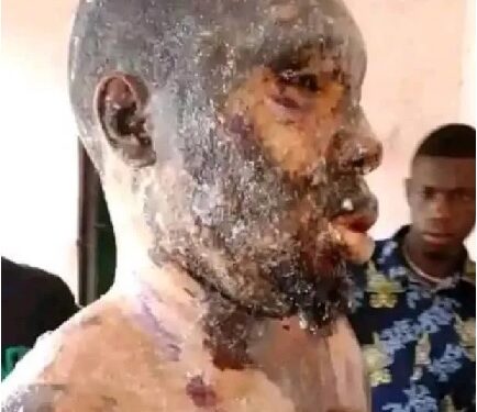 Nigerian Woman Bathes Her Own Husband With Hot Oil In Rivers
