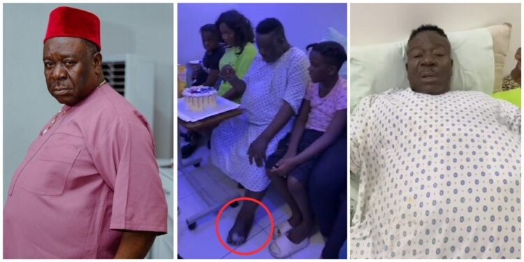 I Don’t Want My Leg To Be Cut Off – Mr Ibu Begs for Money, Prayers From Hospital Bed (Video)