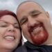 Mother Of Two Dies From Brain Swelling After Drinking Too Much Water