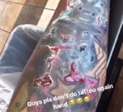 “Please Don’t Do Tattoo” – Man Warns After Suffering Severe Skin Reaction (Video)
