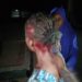 UNIMAID Student Viciously Attacks 21-Year-Old Lady For Rejecting His Love Proposal
