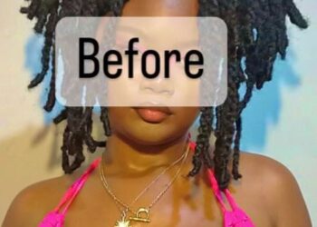 Woman Shows Off Result Of Her Bre*st Reduction Surgery (Photos)
