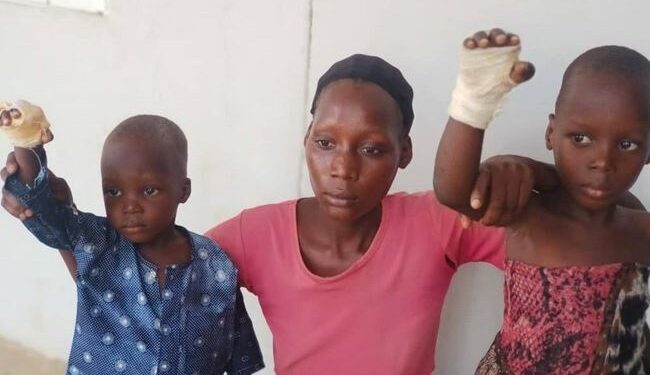 23-Year-Old Nigerian Woman Burns Her Stepchildren’s Hands Over Plate Of Rice