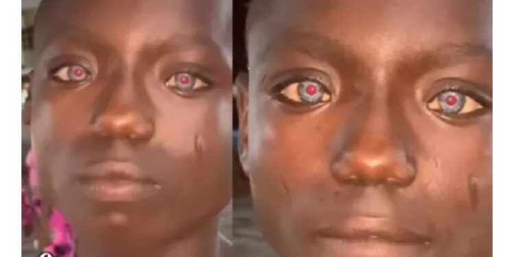 Lady In Awe After Spotting Little Boy With Red And Blue Eyes (Video)