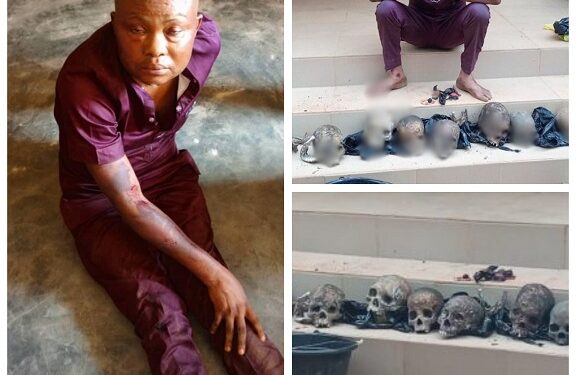 Police Arrest Suspected Ritualist With Eight Human Skulls in Ondo (Photos)
