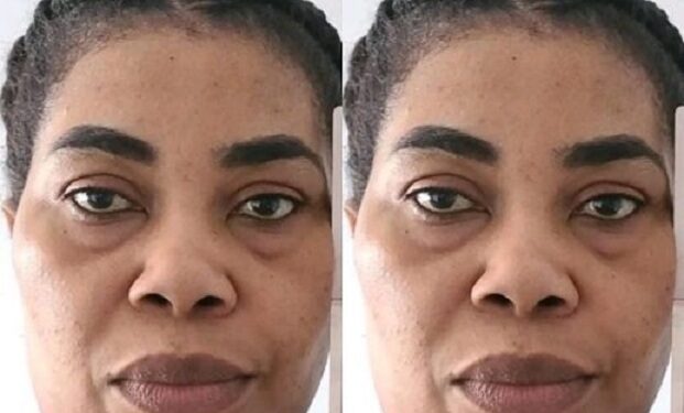Canada-based Nigerian Woman Under Probe For Mass-poisoning Threat