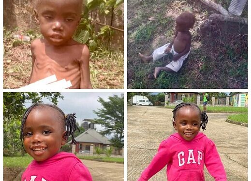 See The Amazing Transformation of Toddler Rescued After Being Accused of Witchcraft And Left To Die in Akwa Ibom (Photos)