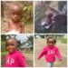 See The Amazing Transformation of Toddler Rescued After Being Accused of Witchcraft And Left To Die in Akwa Ibom (Photos)