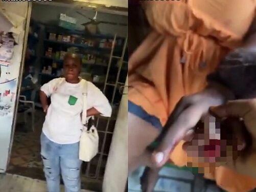 Woman Bites Off Another Woman’s Finger “Because Of A Man” (Video)