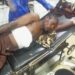 Nigerian Herbalist Hospitalised After Shooting Himself While Testing ‘Bulletproof’ Charm In Abuja (Photos)