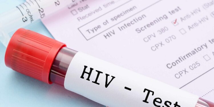 Africa Recording Remarkable Reductions in HIV Infections And Deaths – WHO