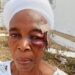 Six ‘Isese’ Worshippers Stoned, Injured In Horrific Attack By Suspected Islamic Extremists At Osun Obatala Festival