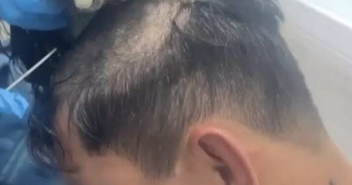 Airport Police Discovers 220g Of Cocaine Worth 10,000 Euros Under Man’s Wig (Video)