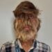 18-Year-Old Indian Boy Suffering From “Werewolf Syndrome” Makes Guinness World Record For Hairiest Face (Photos)