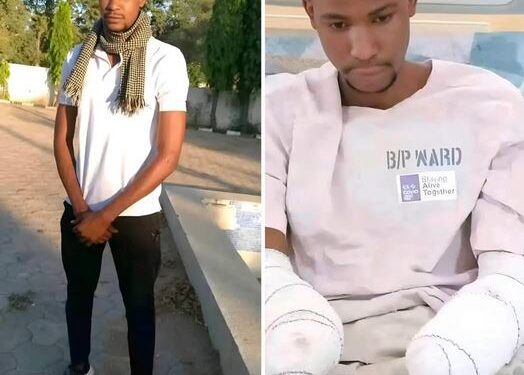 Nigerian Pharmacist Shares Story Of Young Man Who Lost His Arms In Mechanical Accident At Work 5 Days After Employment