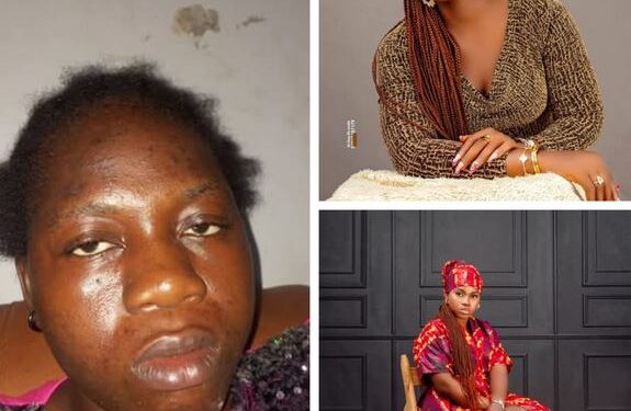 Four Years Of Physical Assault, Fear, And D3ath Threats – Nigerian Woman Shares Harrowing Story As She Leaves Her ‘Abusive’ Marriage