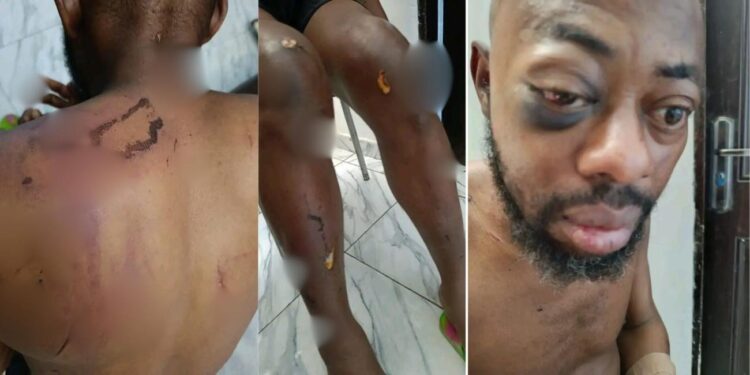 DSS Detains NANS President Atiku Isah In Hospital After Exposing Seyi Tinubu’s N100Million Bribe Offer