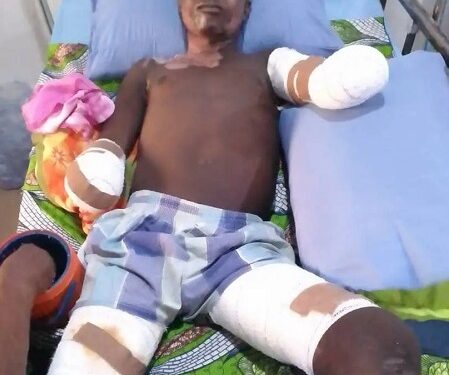 Taraba Poly Student Loses Both Hands While Hoisting PDP Flag