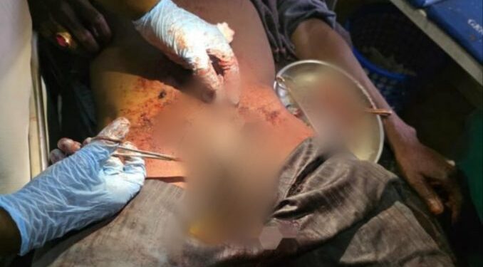 Nigerian Doctors Re-attach Man’s Genitals After Su!cide Attempt Over Divorced Wife