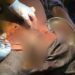 Nigerian Doctors Re-attach Man’s Genitals After Su!cide Attempt Over Divorced Wife
