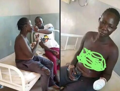 Suspected Herdsmen Chop Off Woman’s Hand in Nasarawa