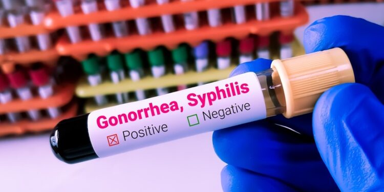 Panic As Gonorrhoea And Syphilis Reach Record Highs in Europe