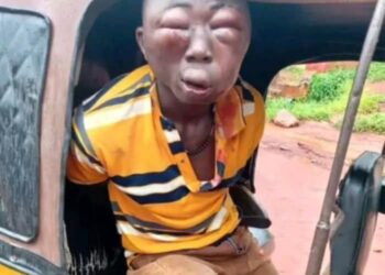 Man Beaten To Pulp After Being Accused Of Stealing Money in Anambra (Photos)