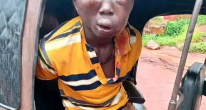 Man Beaten To Pulp After Being Accused Of Stealing Money in Anambra (Photos)