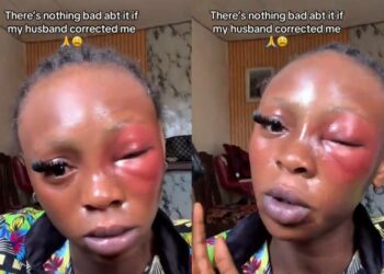 “There’s Nothing Bad About It” — Lady Says It’s Okay For Husband To Beat Her (Video)