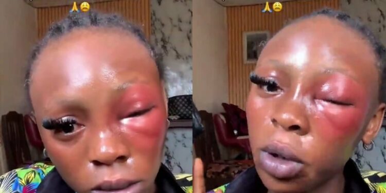 “There’s Nothing Bad About It” — Lady Says It’s Okay For Husband To Beat Her (Video)