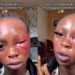 “There’s Nothing Bad About It” — Lady Says It’s Okay For Husband To Beat Her (Video)