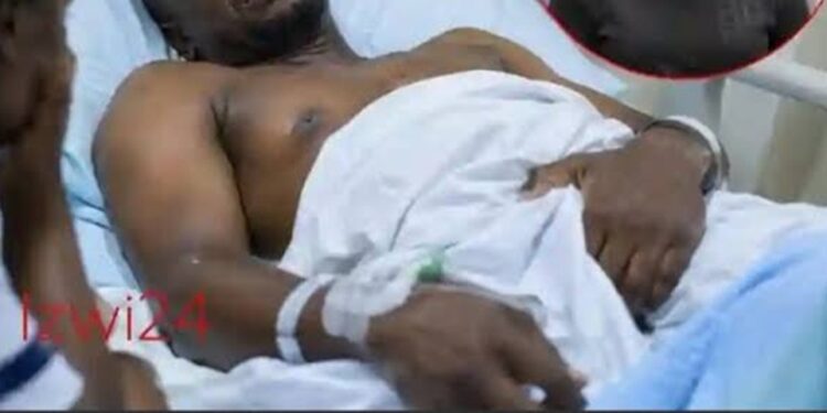 Man Left Fighting For His Life In Hospital After Wife Allegedly Bites His Private P@rt